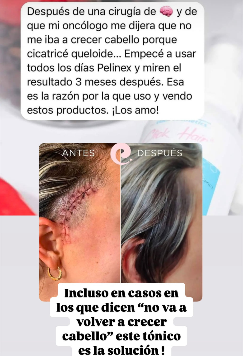 Tónico Pelinex para crecimiento Capilar 60ml