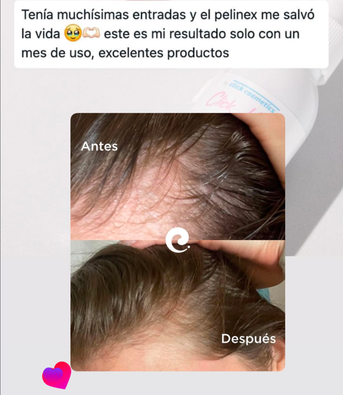 Tónico Pelinex para crecimiento Capilar 60ml