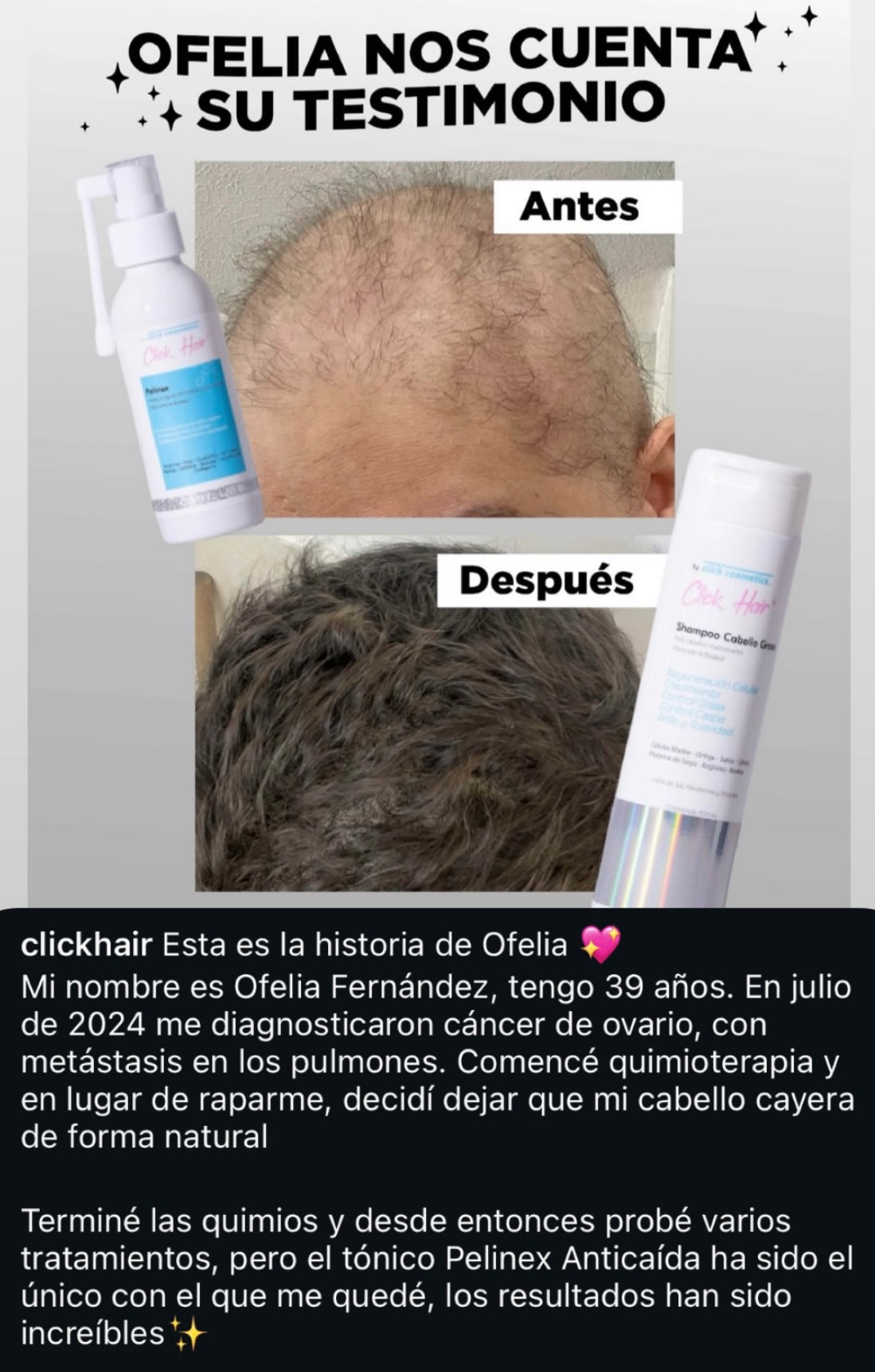 Tónico Pelinex para crecimiento Capilar 60ml